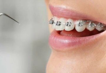 Pediatric Dental Care